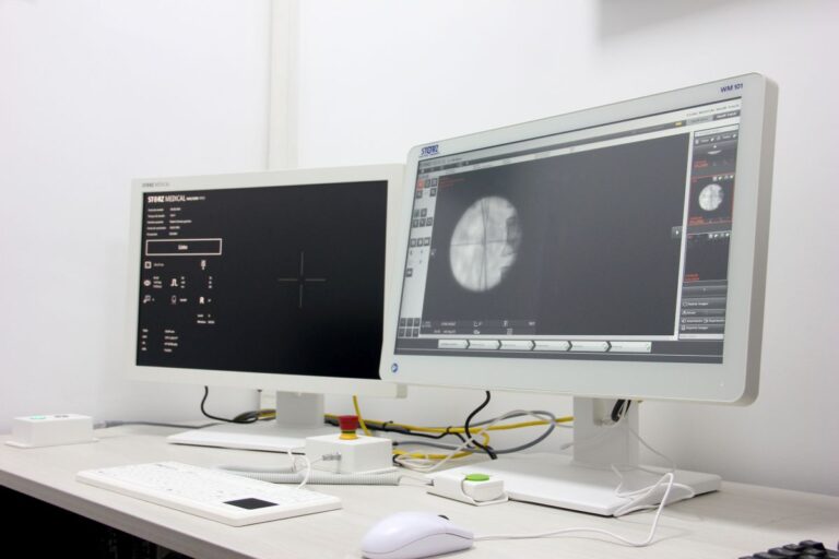 Monitores de imagem do sistema de litotripsia