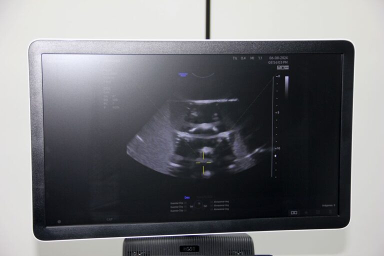 Tela de ultrassonografia do sistema hospitalar